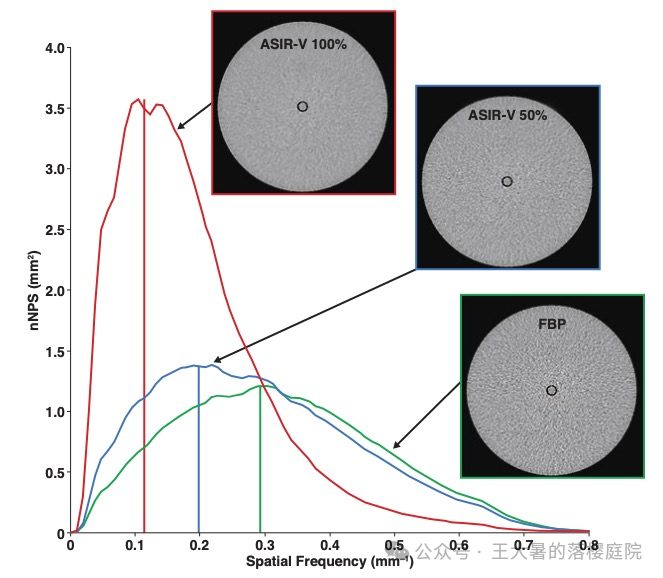 #105 CT重建的3D深度学习技术——迭代算法详解 #105 CT重建的3D深度学习技术——迭代算法详解